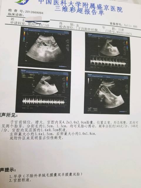 能嫁给大老板的女人面相求学业